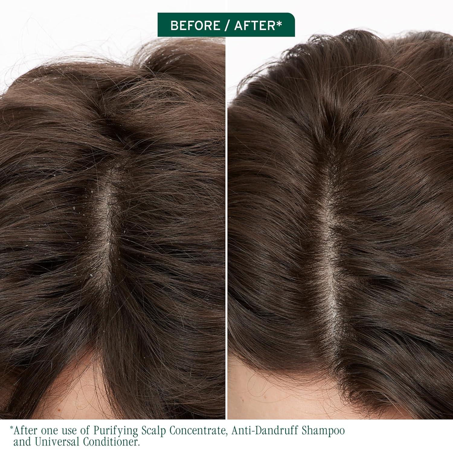 image:imageBiolage Scalp Sync AntiDandruff Shampoo Controls Itchy Scalp Deeply Cleanses Moisturizing Dandruff Treatment With Zinc Pyrithione Vegan amp CrueltyFree 135 Fl Oz338 Fl Oz Pack of 1