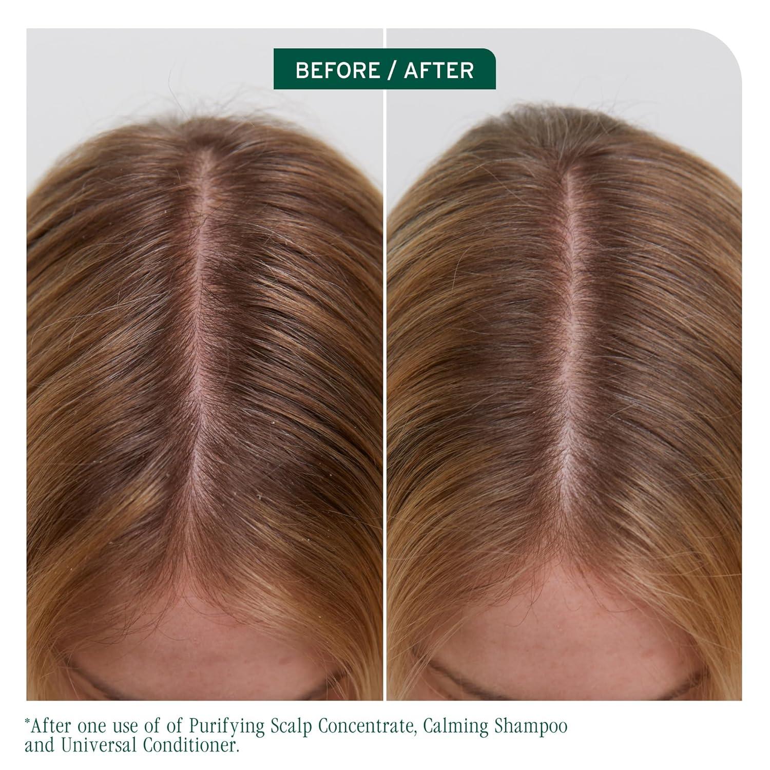 image:imageBiolage Scalp Sync Clarifying Shampoo and Universal Conditioner Set Residue amp Buildup Remover For Oily Scalp Fermented Tea amp Glycolic Acid Vegan amp ParabenFree