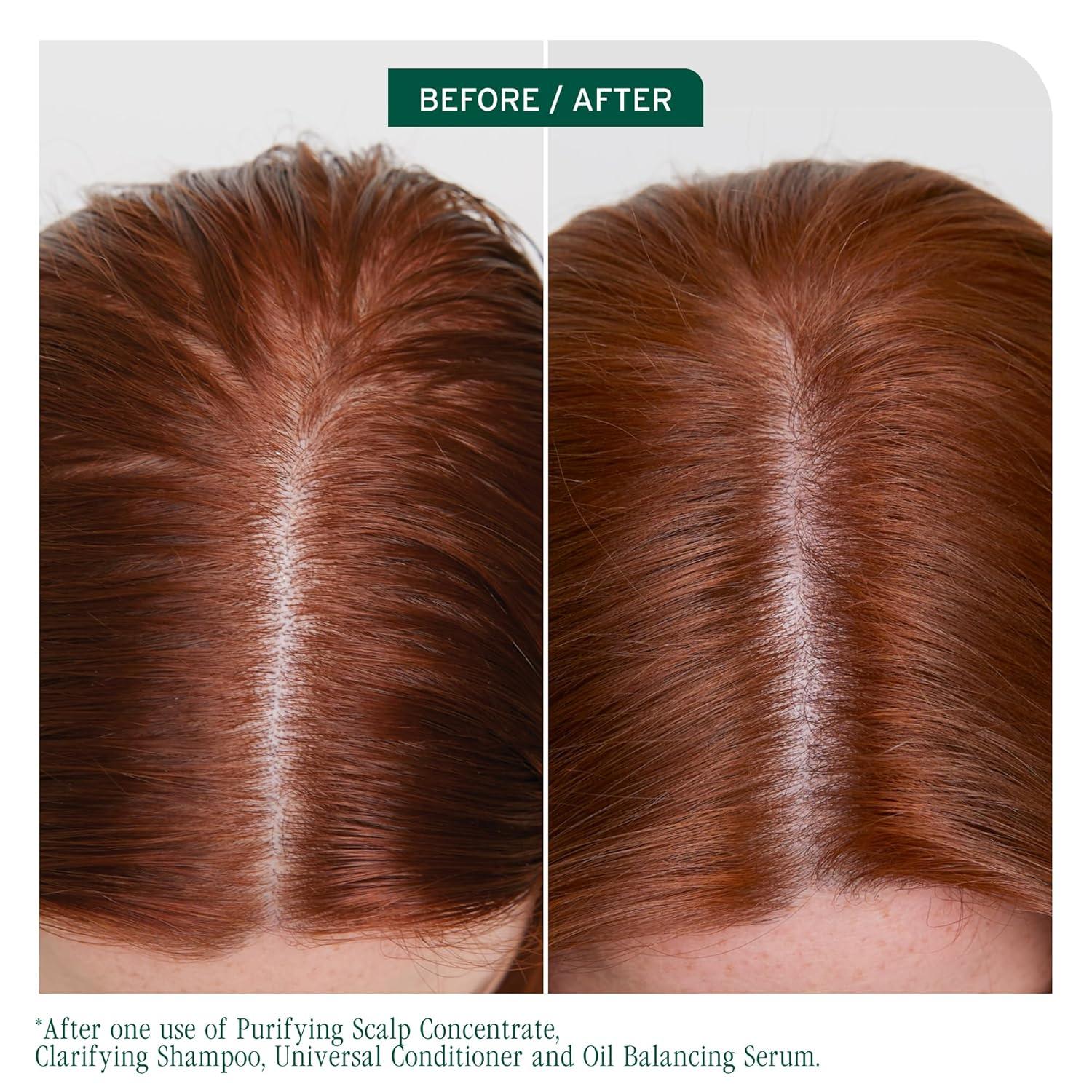 image:imageBiolage Scalp Sync Clarifying Shampoo and Universal Conditioner Set Residue amp Buildup Remover For Oily Scalp Fermented Tea amp Glycolic Acid Vegan amp ParabenFree