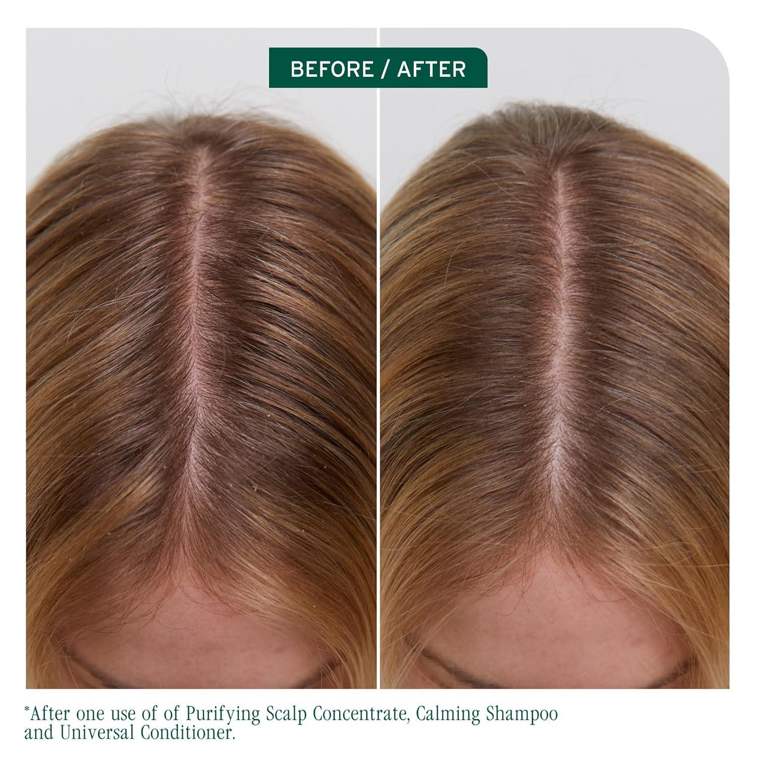 image:imageBiolage Scalp Sync Universal Conditioner Nourishing amp Hydrating for All Scalp Types Lightweight Moisturizing amp Conditioning Fermented Tea Blend amp Glycolic Acid Vegan amp ParabenFree79 Fl Oz
